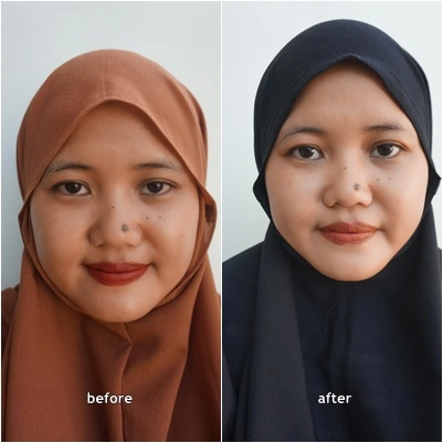 before after beautivi